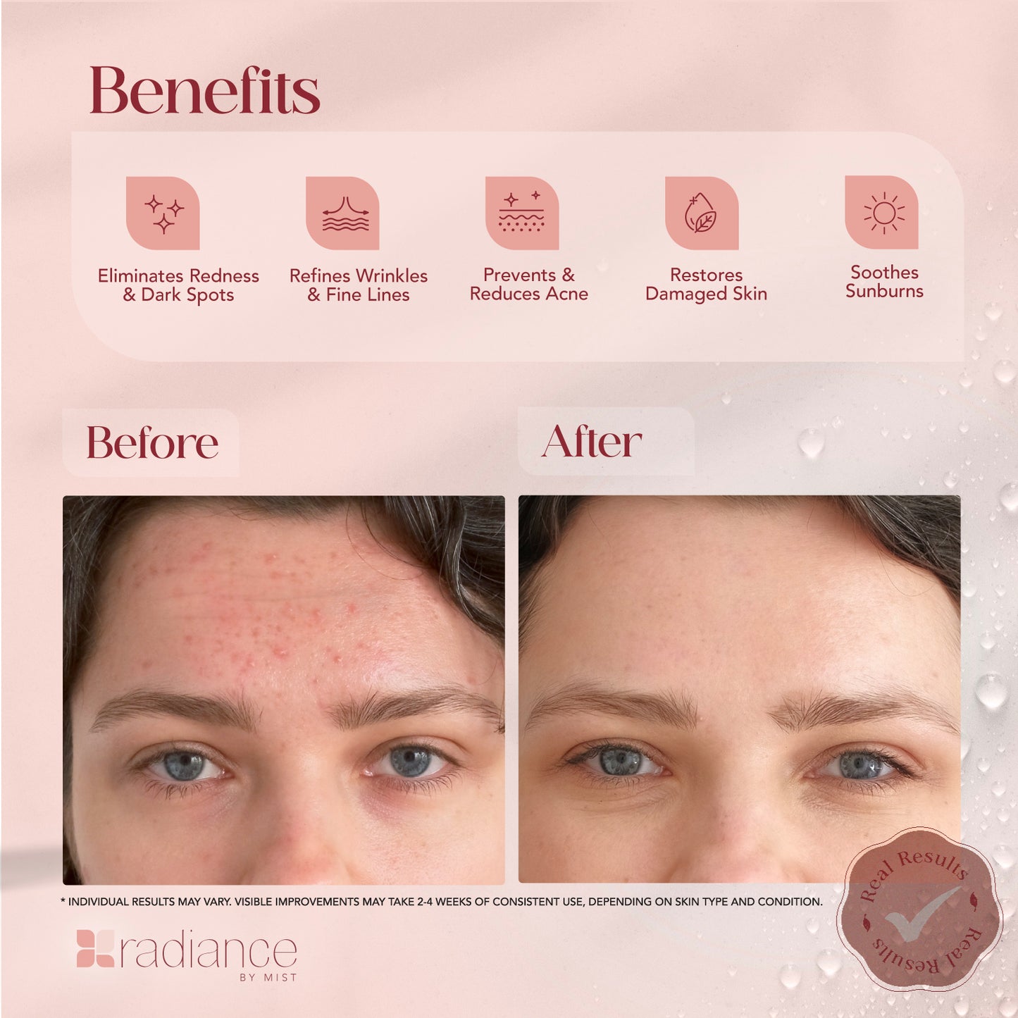 Radiance Snail Mucin Serum with Advanced Snail 96% Mucin Power Essence, Korean Skin Care with Hydrating Hyaluronic Acid Korean Serum, 3.38 fl oz, 100ml